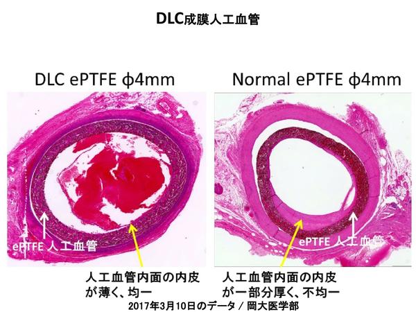 DLC成膜人工血管②